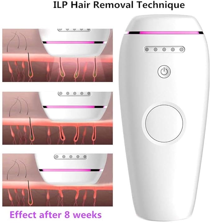 IPL Hair Removal Device