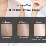 IPL Hair Removal Device