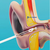 DW™ Ear Wax Cleaner